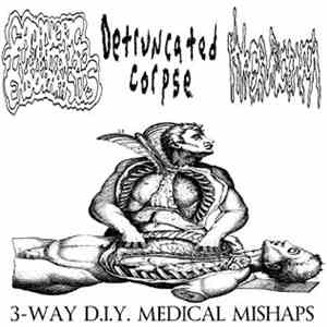 Cadaveric Incubator Of Endoparasites / Detruncated Corpse / Hyperuricemia - 3-Way D.I.Y. Medical Mishaps download free